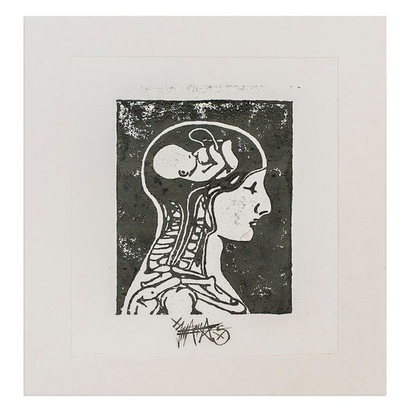 Alternate image for Expressionist Xylograph Print of X-Ray of Man and Fetus Conception